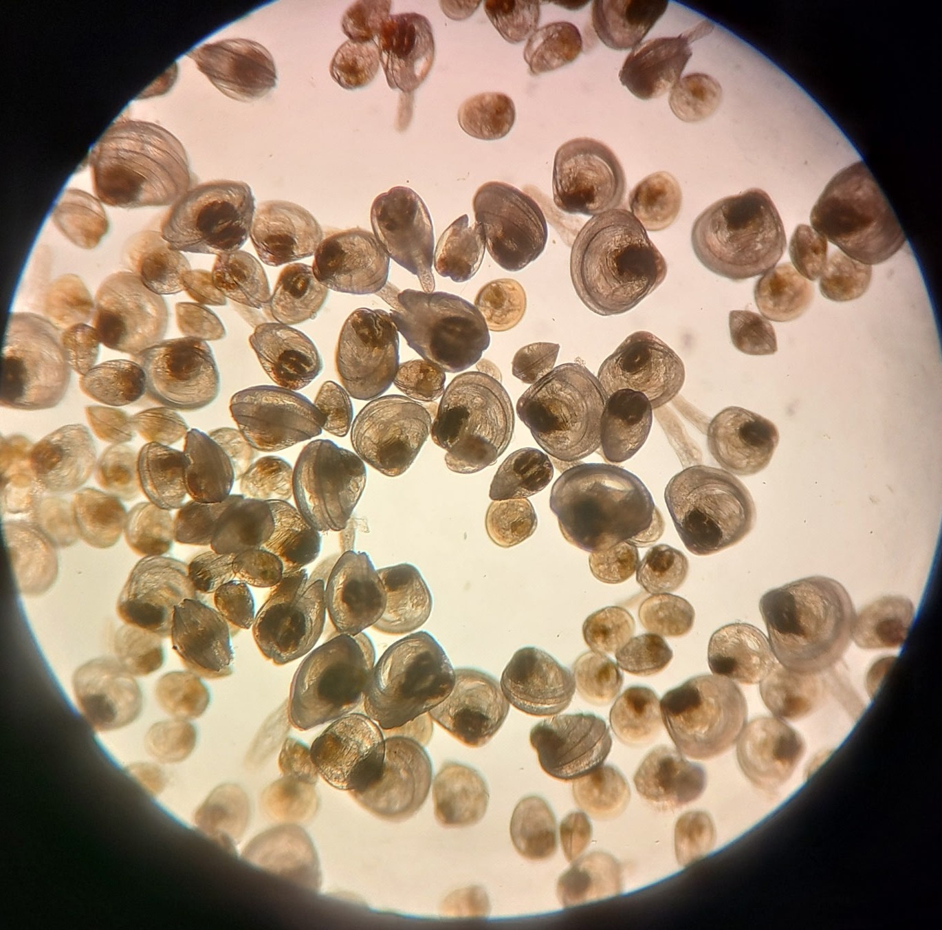 Hard clam larvae under the microscope